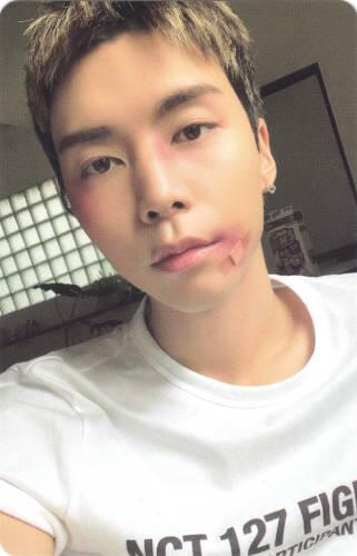 Photocard of Johnny with cuts and a bandaid on his face